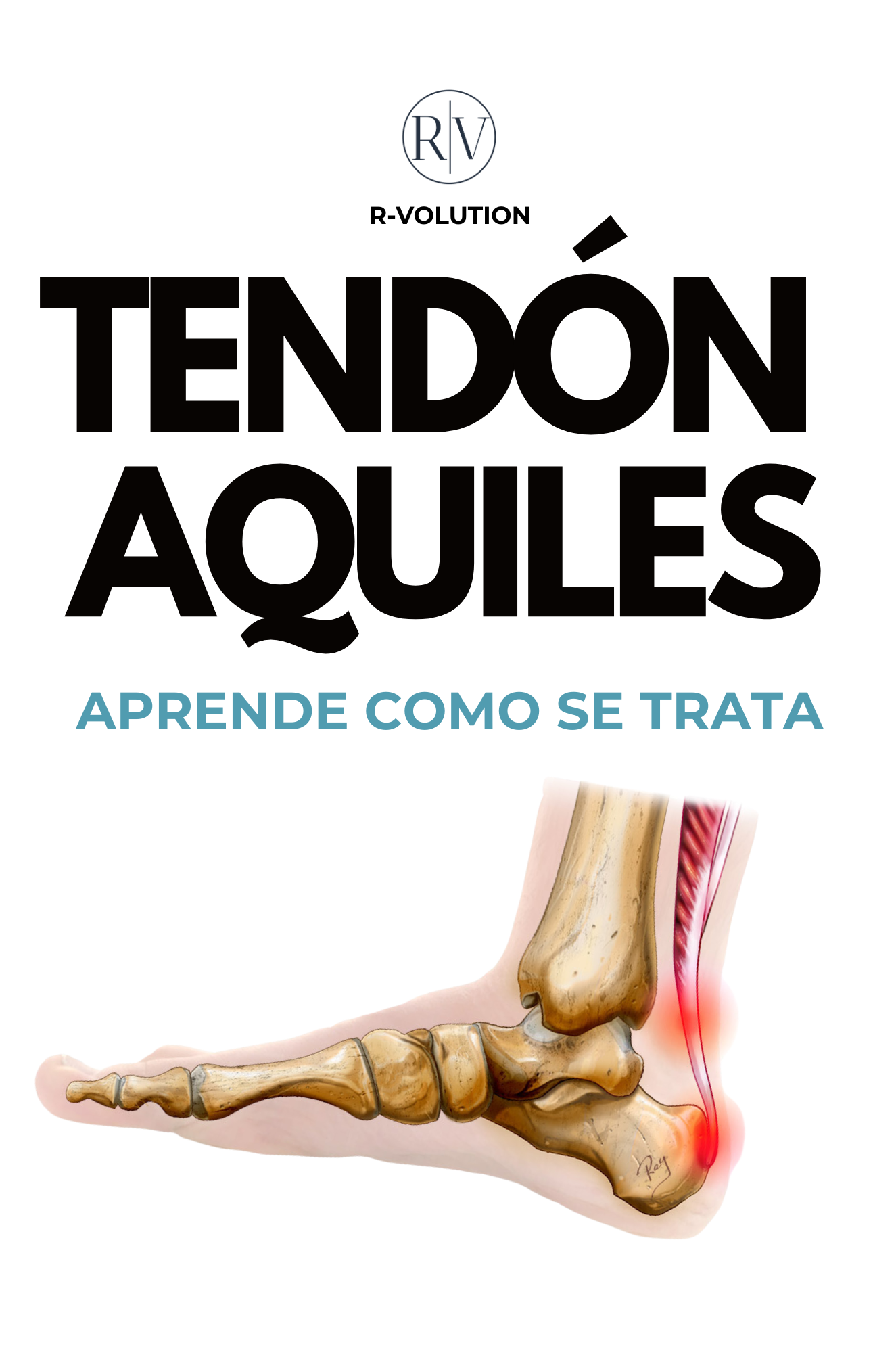 TENDÓN DE AQUILES - APRENDE A TRATARLO