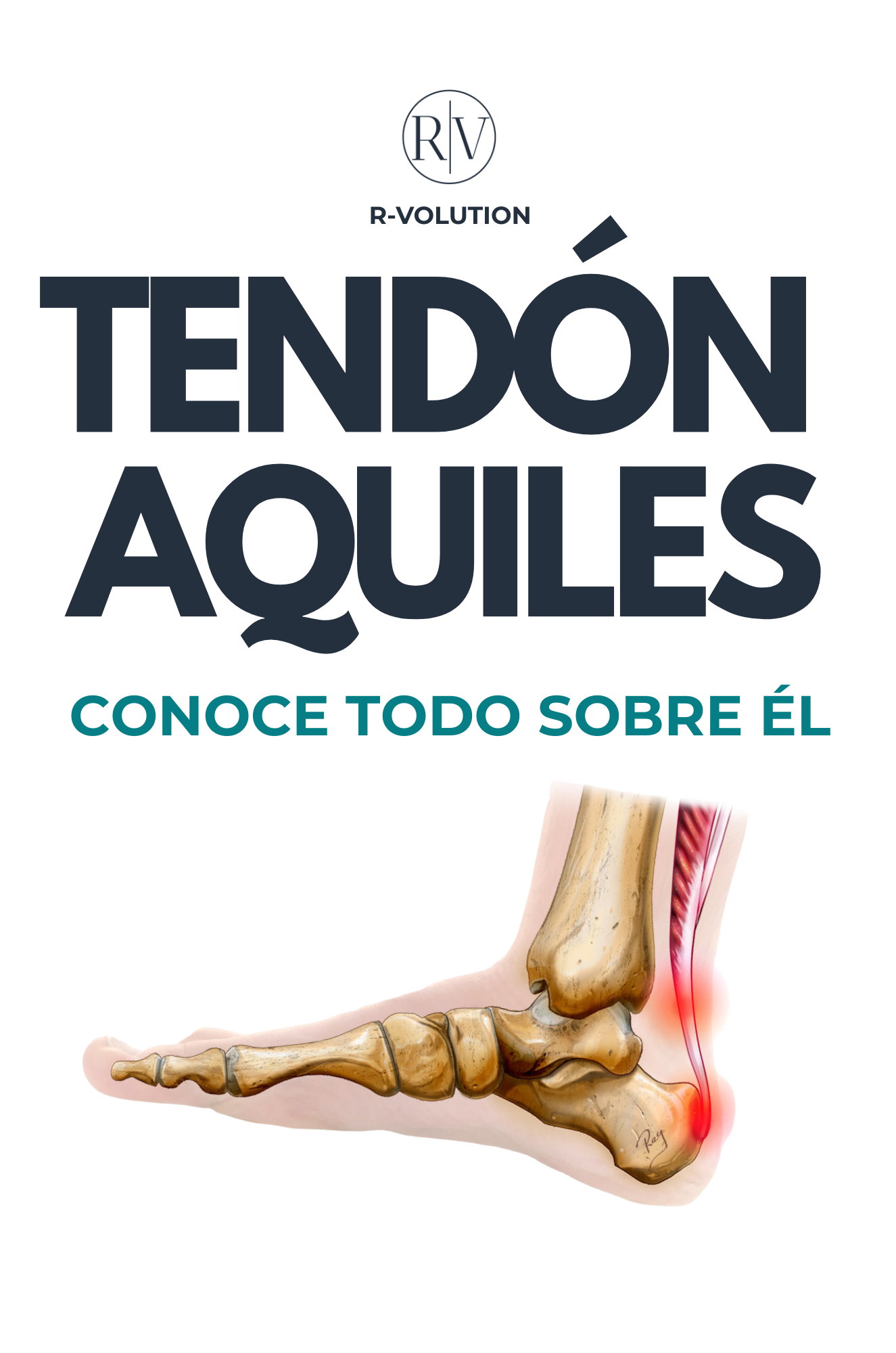 TENDÓN DE AQUILES - CONÓCELO