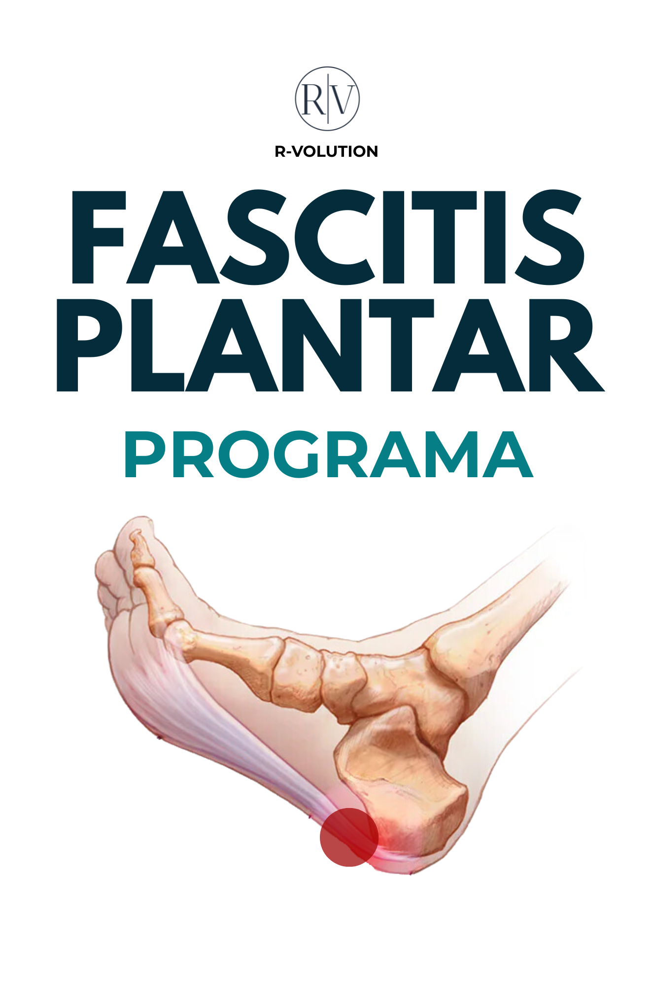 FASCITIS PLANTAR - PROGRAMA PARA TRATARLA