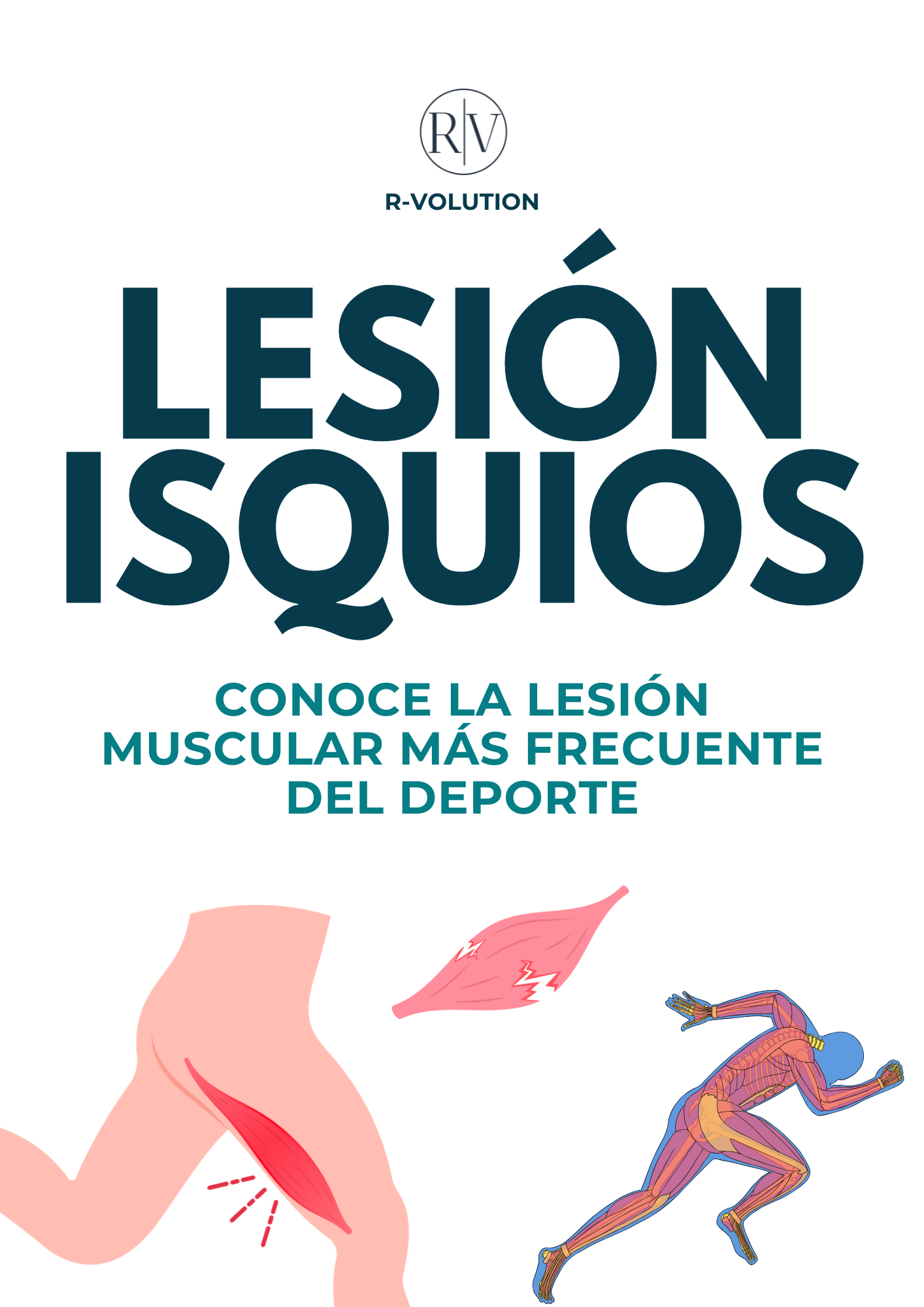 Isquios